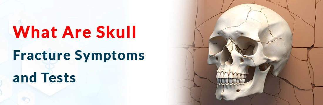  What Are Skull Fracture Symptoms and Tests